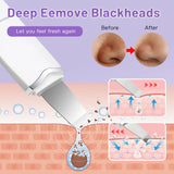 Ultrasonic Facial Skin Scrubber – Blackhead Remover & Pore Deep Cleanser
