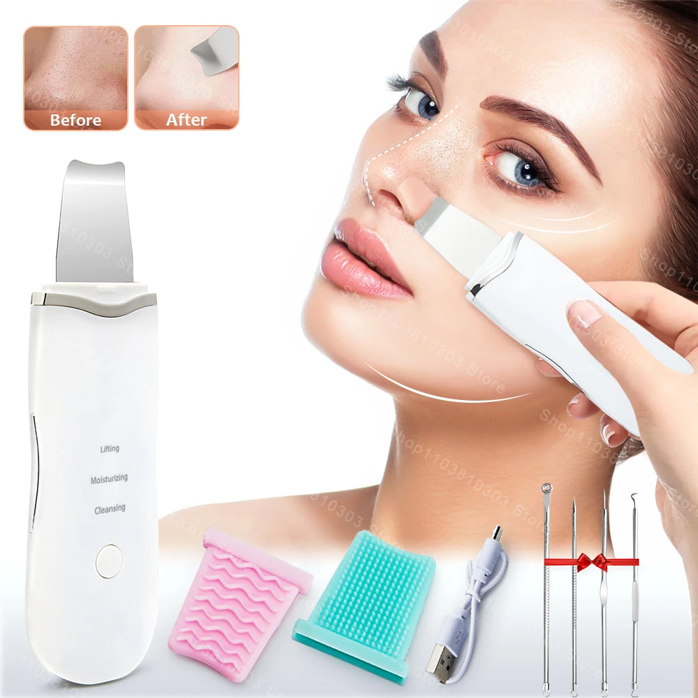 Ultrasonic Facial Skin Scrubber – Blackhead Remover & Pore Deep Cleanser